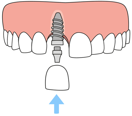 Dentist in 78052 TX