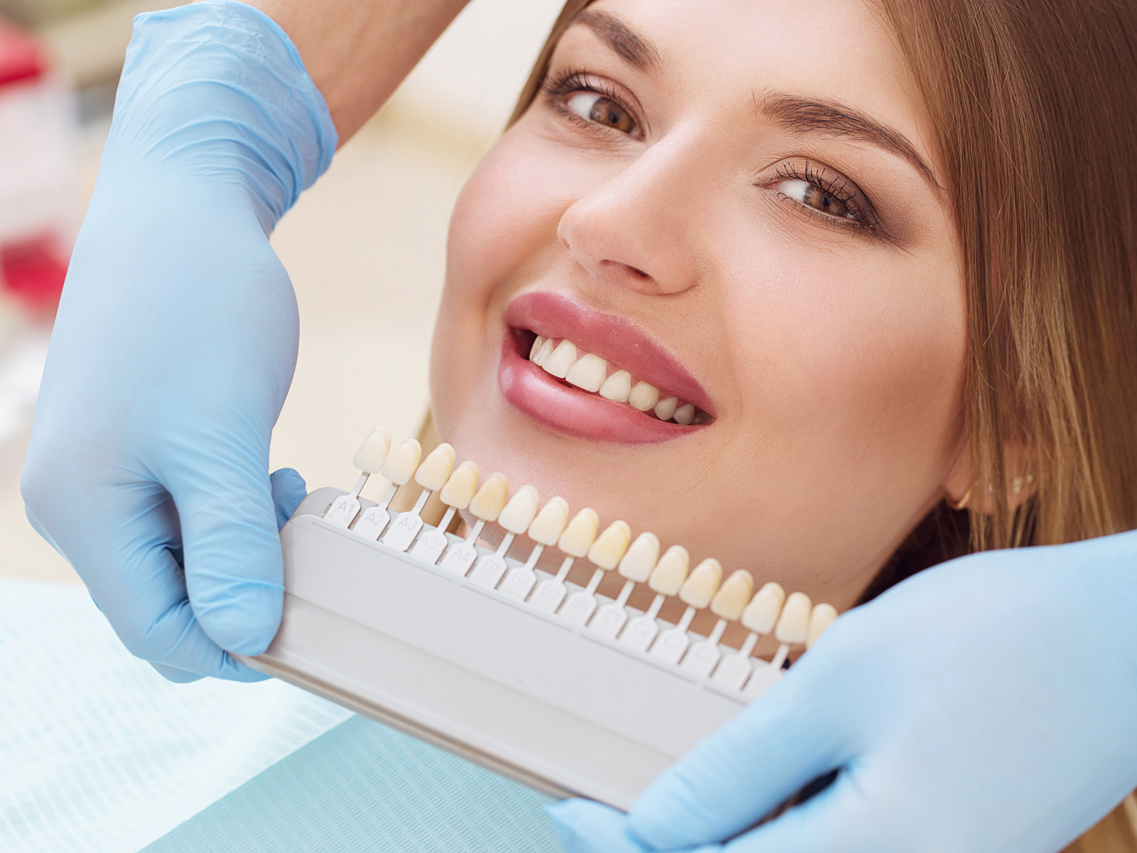 How Can I Keep My Veneers In Good Condition?