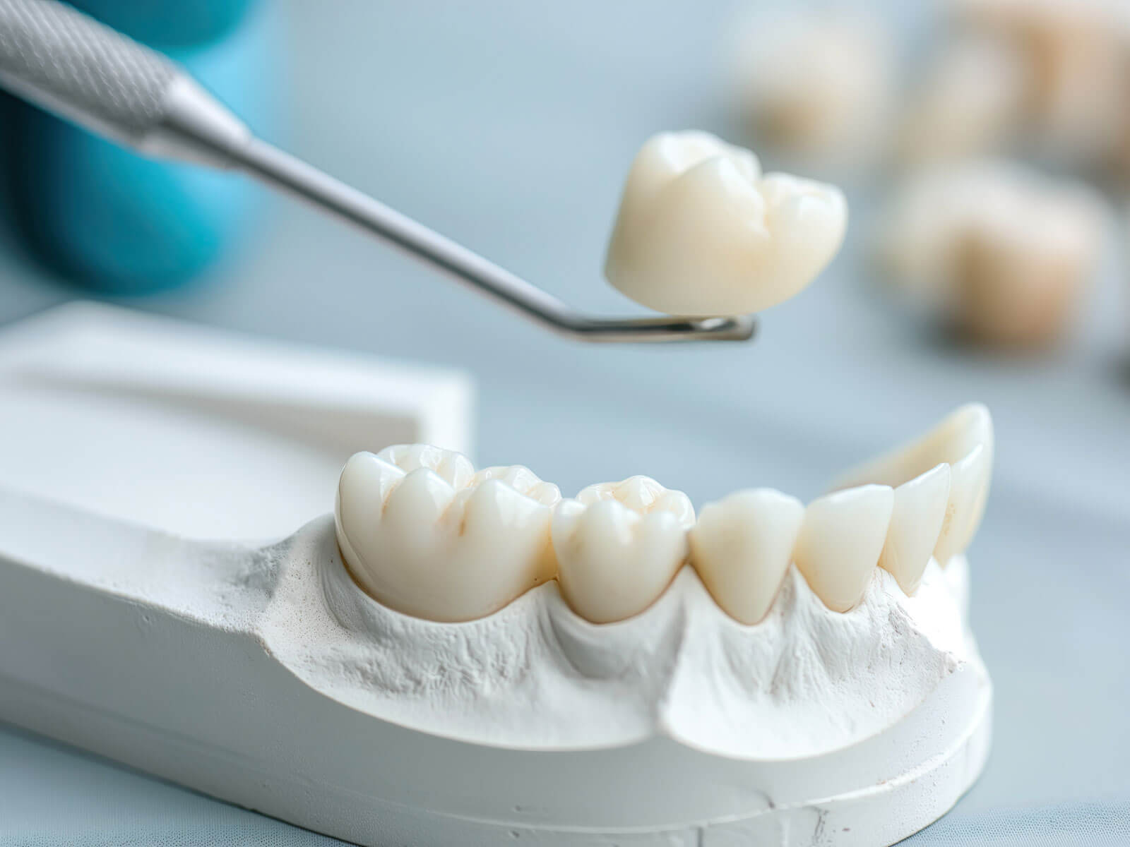 Dental Crown Cost 2026: By Material, With/Without Insurance & What Affects the Price